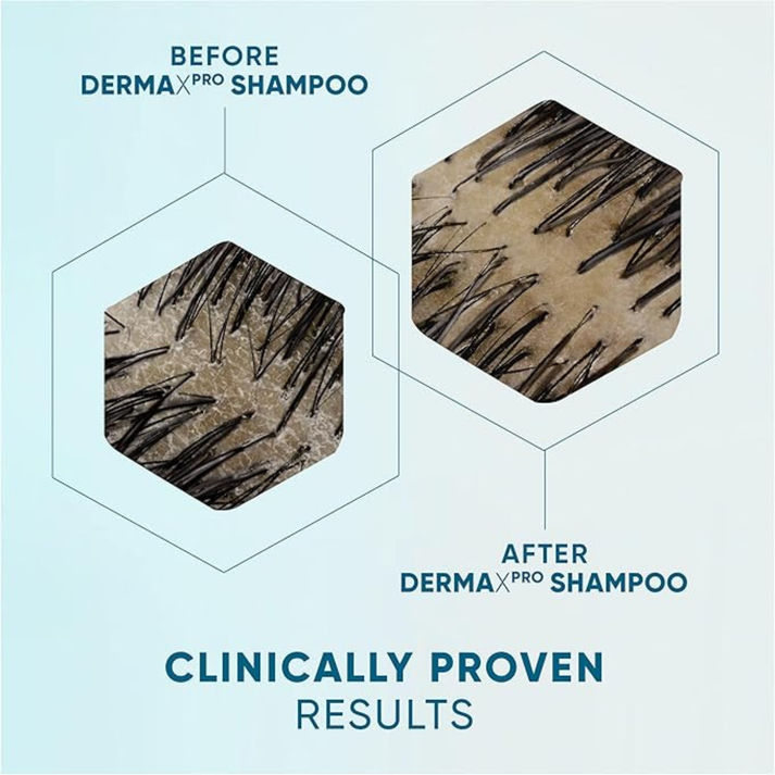 Head & Shoulders | הד אנד שולדרס - DERMA X PRO Sensitive | שמפו סנסיטיב לקרקפת רגישה עם דבש מאנוקה (300 מ"ל)