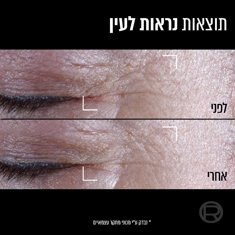 L'Oréal Paris Age Perfect Cell Renew Midnight Eye Cream - 15ml | קרם עיניים מידנייט לוריאל