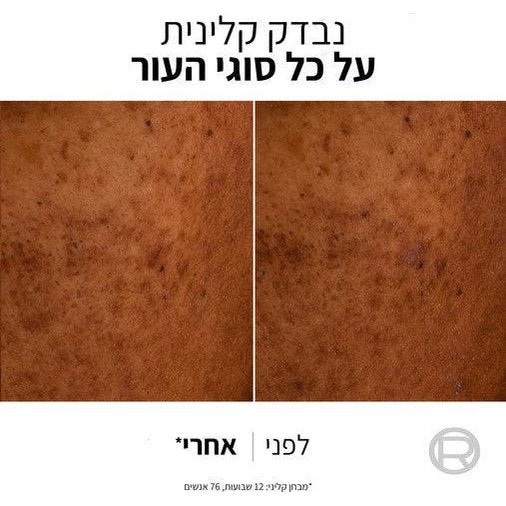 L'Oréal Paris Bright Reveal Dark Spot UV Fluid SPF50+ | תחליב הגנה לטשטוש כתמים כהים