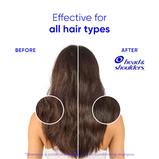 Head & Shoulders | הד אנד שולדרס - Smooth & Silky | שמפו למניעת קשקשים לשיער רך כמשי (625 מ"ל)