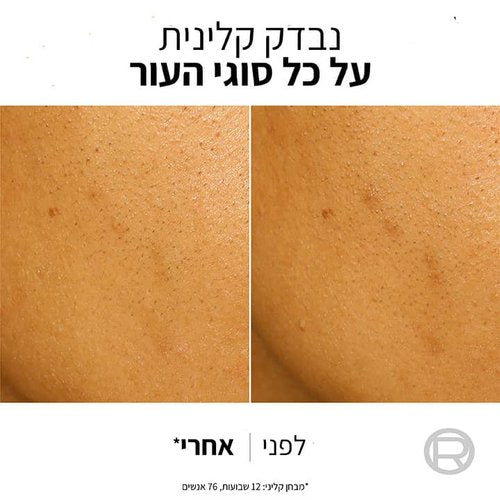 L'Oréal Paris | לוריאל פריז - Bright Reveal | מסכת פילינג ניאצינאמיד וחומצות בריכוז 25%