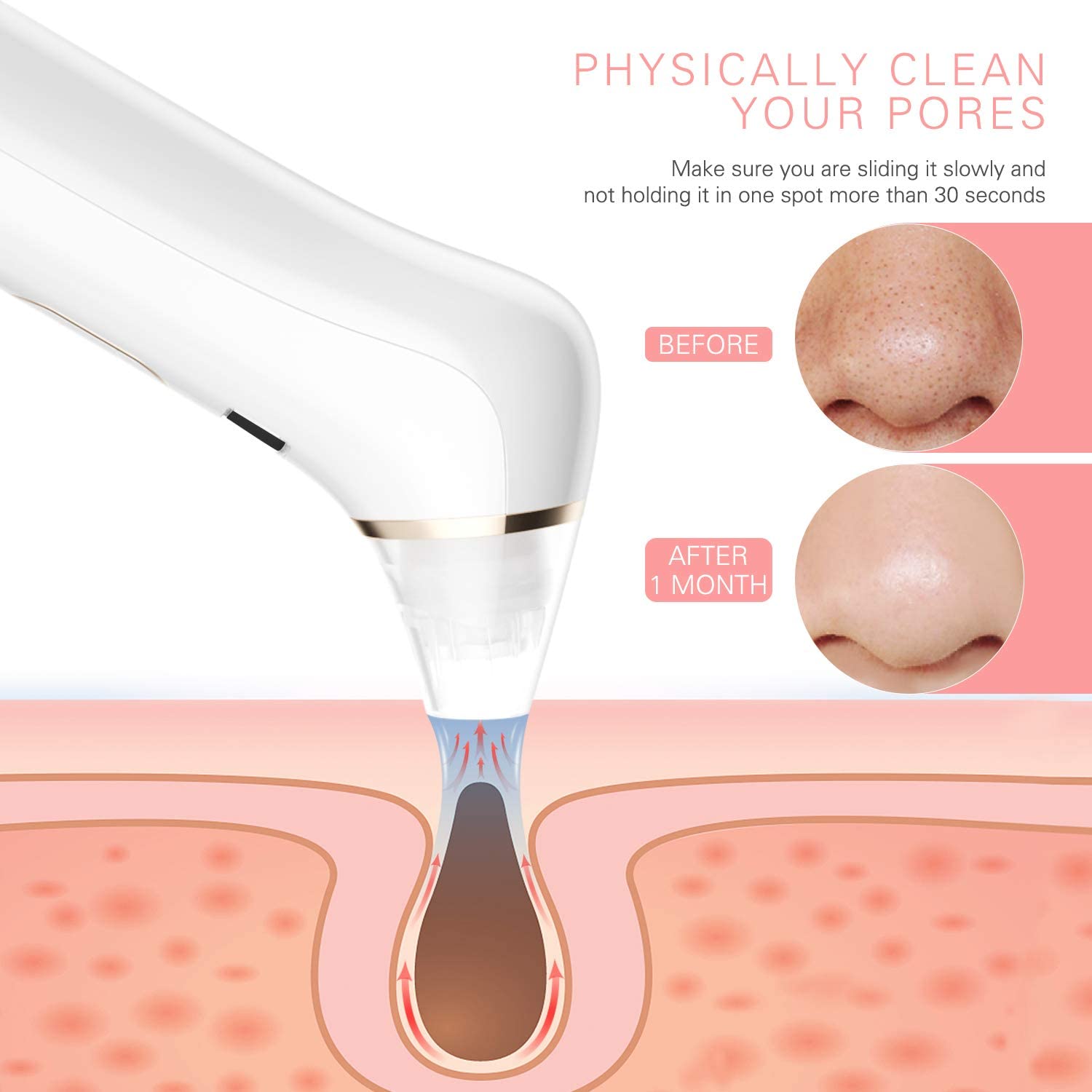 Removes blackheads with blue light for a perfect facial treatment with an American FDA standard